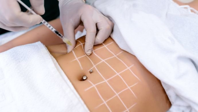 Lipo Sem Cortes