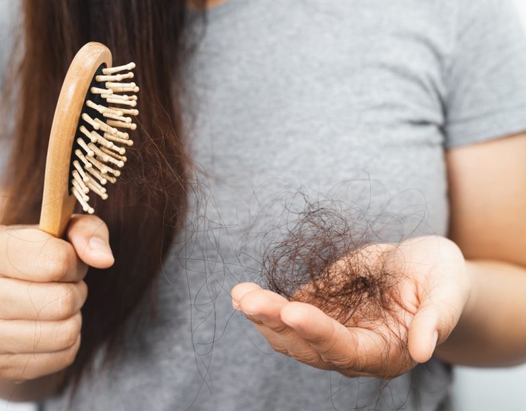 Mulher com cabelo na mão em um episódio de queda de cabelo