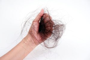Queda de cabelo